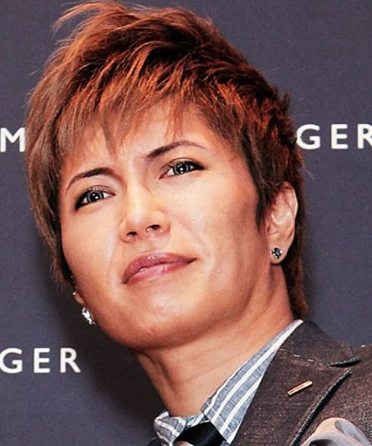 GACKTの病気がガセの理由6つ!詐欺や不倫疑惑・整形で日本に戻れない